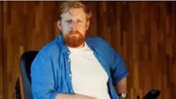 وفاة الفنان الأيرلندي مايكل باتريك بعد صراع مع المرض