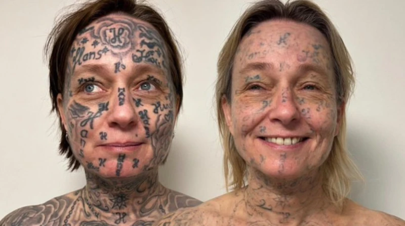 لتمييزها كملكية خاصة. هولندية تزيل 250 وشمًا رسمها حبيبها على جسدها (صور)