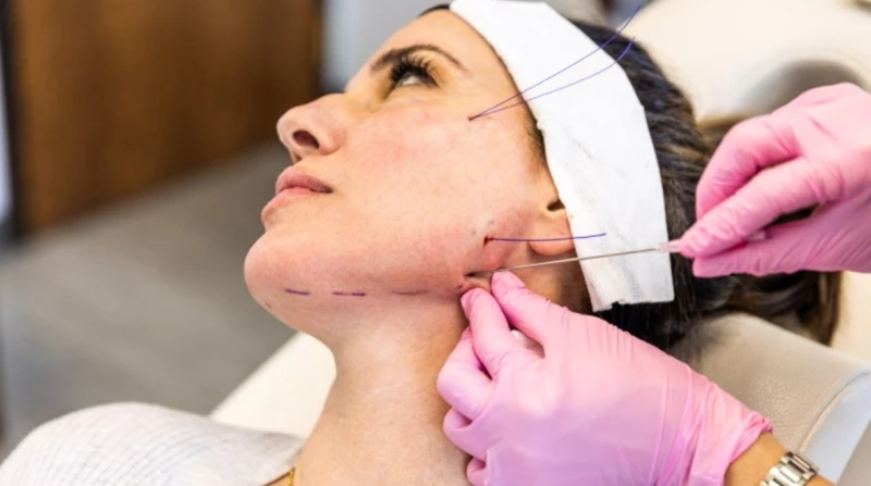 نتائج مؤقتة وندم مستمر. أطباء تجميل يكشفون سر تخلي النساء عن اللوك الوهمي