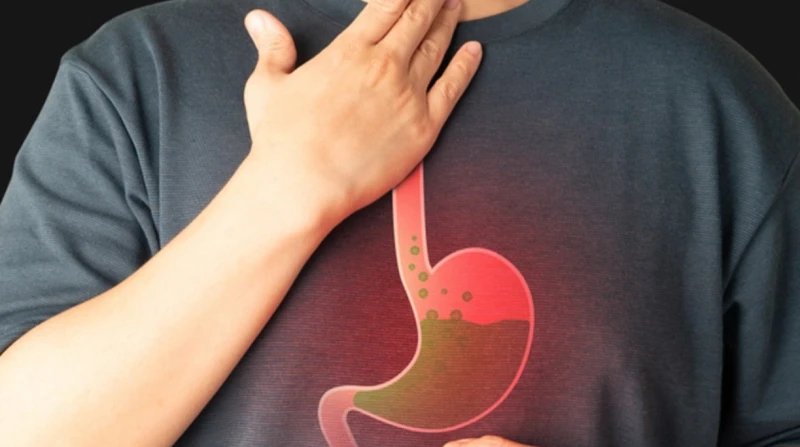 علاج ارتجاع المريء في المنزل، كيف تتخلص من الحموضة