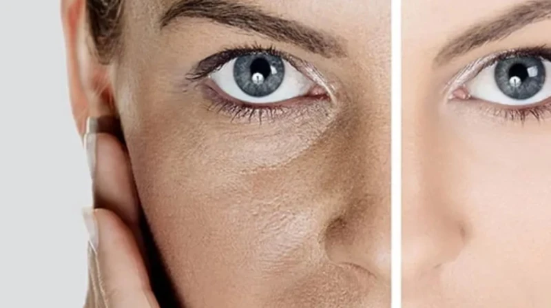 يقلل تجدد الخلايا. سبب علمي وراء فقدان البشرة للنضارة
