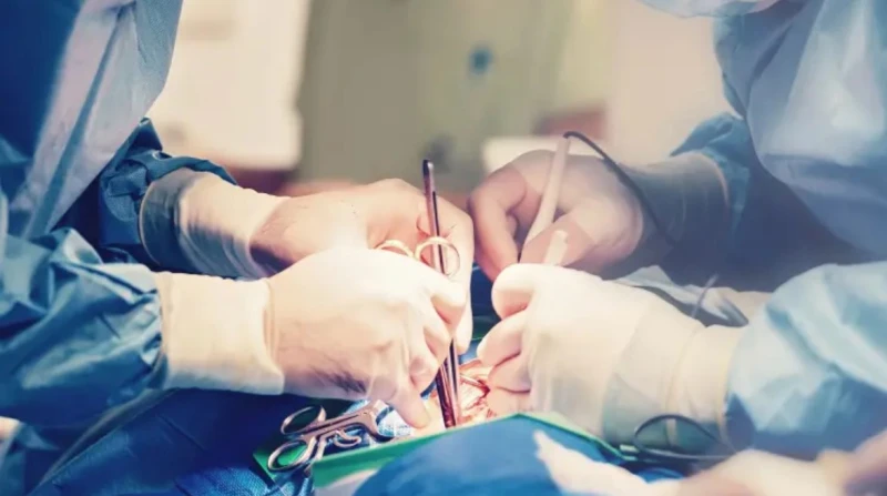 استأصل الكبد بدل الطحال. خطأ طبي يثير الجدل في أمريكا