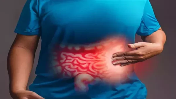 استشاري تغذية: “مشاكل القولون” مصطلح واسع يضم عشرات الأمراض.. وهذه أبرز الأسباب