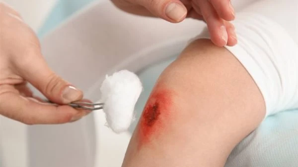 جرح بسيط قد يتحول لخطر.. الصحة تحذر: هذه العلامات لا تتجاهلها أبدًا