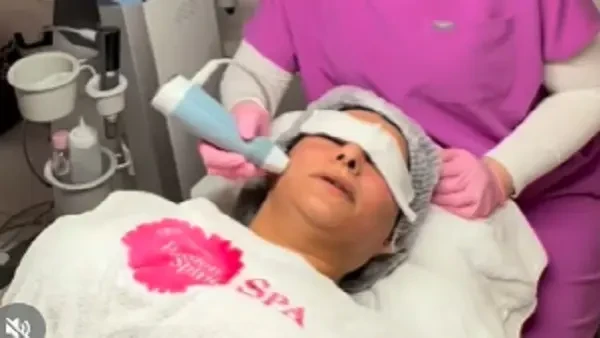 ميكرونيدلينج حمض السالمون يتصدر واجهة الاهتمامات التقنية والتجميلية في العالم